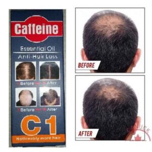 Caffeine Hair Loss Essential Oil